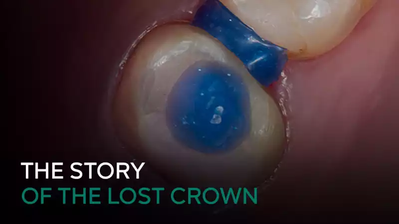 12.The story of the lost crown-title